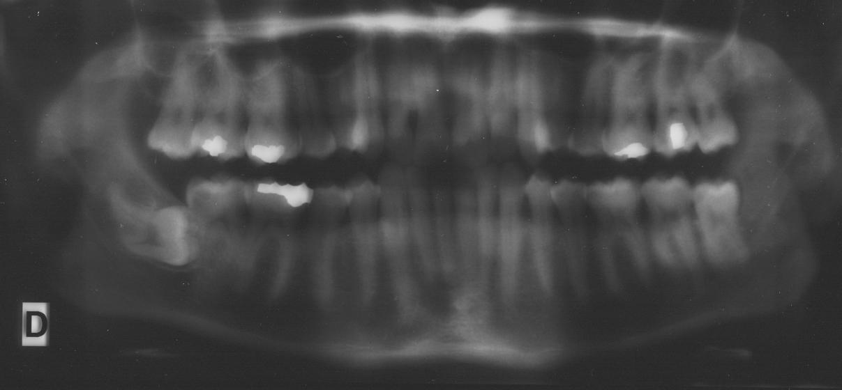 teeth